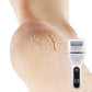 🏆75% de réduction pour une durée limitée✨🌸Extracteur de callosités électrique portatif pour les pieds