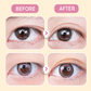🌸Offre spéciale : Achetez 3, obtenez 5 GRATUITES !✨ Bandes invisibles double paupière avec effet agrandissant instantané 👁️🌟