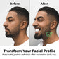 💪 50 % de réduction 🏋️ Balle entraîneur musculaire pour mâchoire – Pour un visage sculpté, défini & plus ferme – idéal pour la musculation faciale 😬