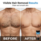 🧴 ACHETEZ 2, OBTENEZ 1 GRATUIT ! ⏰ Crème dépilatoire douce pour hommes – Formule pour peau sensible – Élimine les poils sans irritation, effet hydratant – idéale pour torse, jambes ou aisselles ✨💪