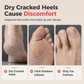 🦶 50% DE RÉDUCTION! 🔧 Callosité 3‑en‑1 – Pierre ponce pour pieds doux ✨